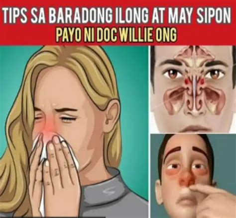 baradong ilong home remedy|Tips sa baradong ilong at may sipon .